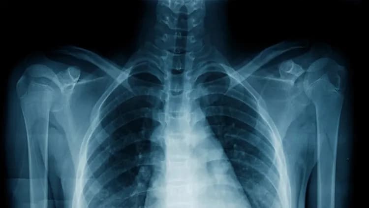 X-ray technician arestado sa Maynila dahil sa umano’y secret videos ng mga pasyente
