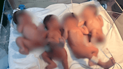 31-anyos na ina sa Batangas, nagsilang ng apat na identical na sanggol na babae
