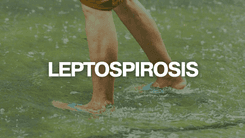 DOH, nagpaalala sa sintomas ng leptospirosis matapos ang baha