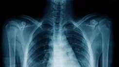 X-ray technician arestado sa Maynila dahil sa umano’y secret videos ng mga pasyente