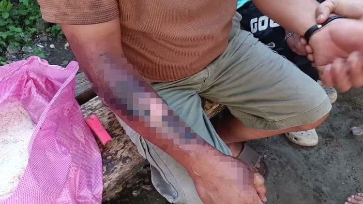 Lalaking tumulong sa pag-apula ng sunog sa Zamboanga City, sugatan